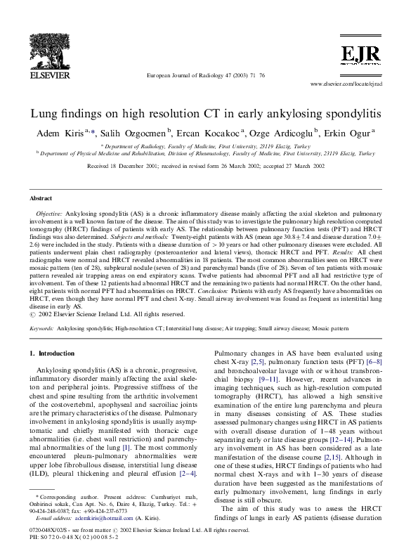 Untreated ankylosing spondylitis picture