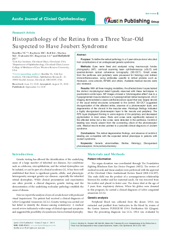 (PDF) Austin Journal of Clinical Ophthalmology