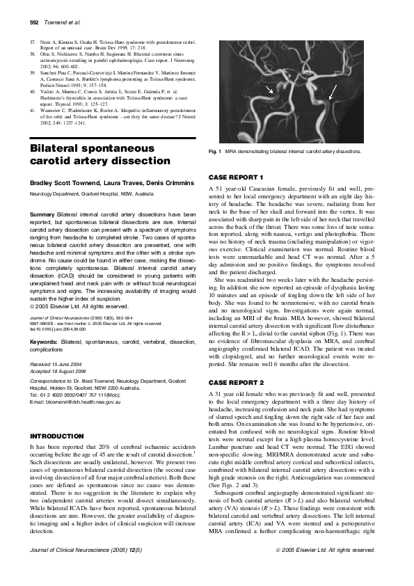 (PDF) Bilateral spontaneous carotid artery dissection