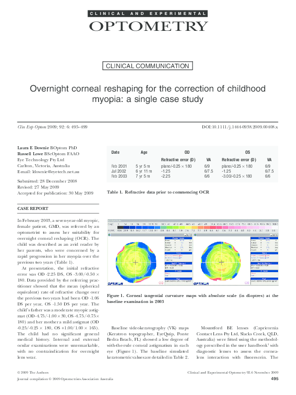 Unilateral progressive myopia picture