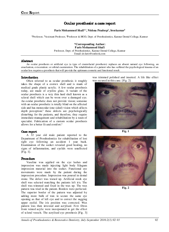 (PDF) Ocular prosthesis: a case report