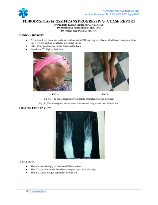(PDF) FIBRODYSPLASIA OSSIFICANS PROGRESSIVA- A CASE REPORT (Case Report ...