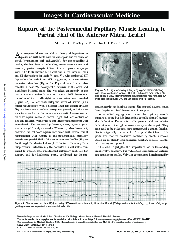 (PDF) Rupture of the Posteromedial Papillary Muscle Leading to Partial ...