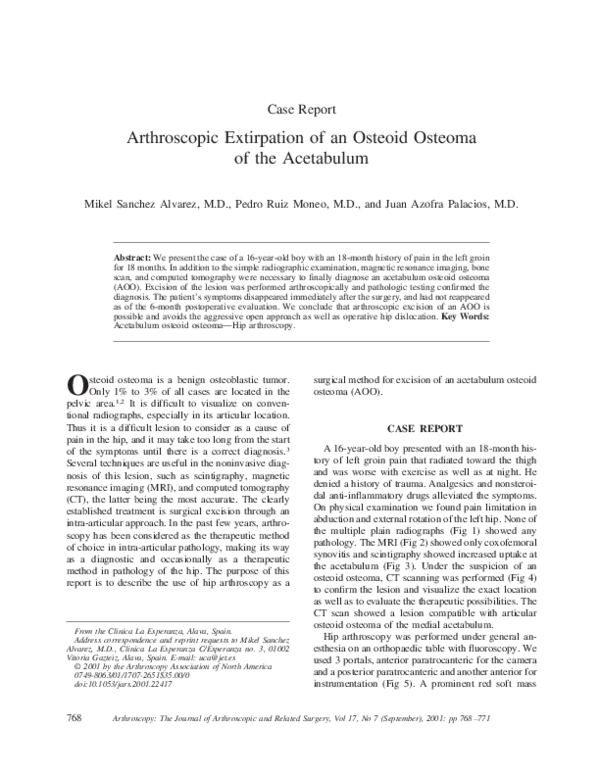 (PDF) Arthroscopic extirpation of an osteoid osteoma of the acetabulum