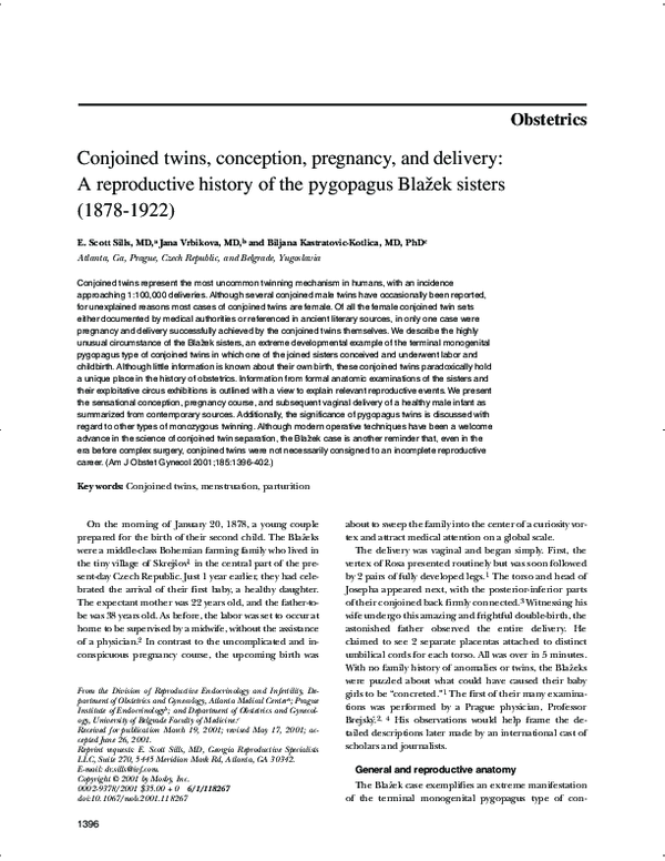 (PDF) Conjoined twins, conception, pregnancy, and delivery: A ...