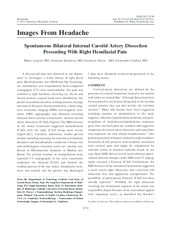 (PDF) Spontaneous Bilateral Internal Carotid Artery Dissection ...