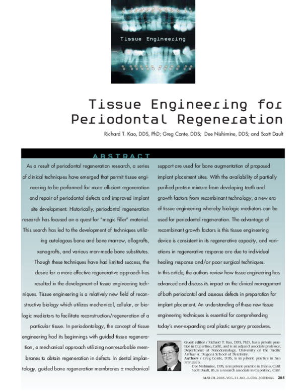 (PDF) Tissue Engineering for Periodontal Regeneration