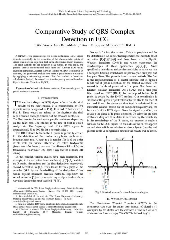 (PDF) Comparative Study of QRS Complex in ECG