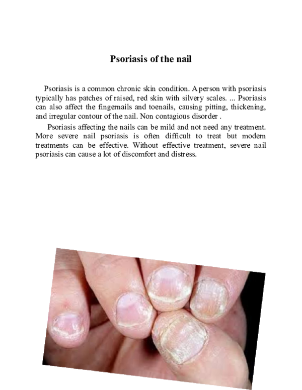 (DOC) Psoriasis of the nail Stefan Croitoru Academia.edu