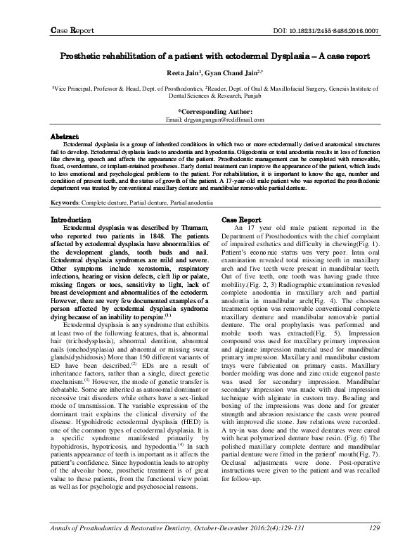 Ectodermal dysplasia essay 06 image