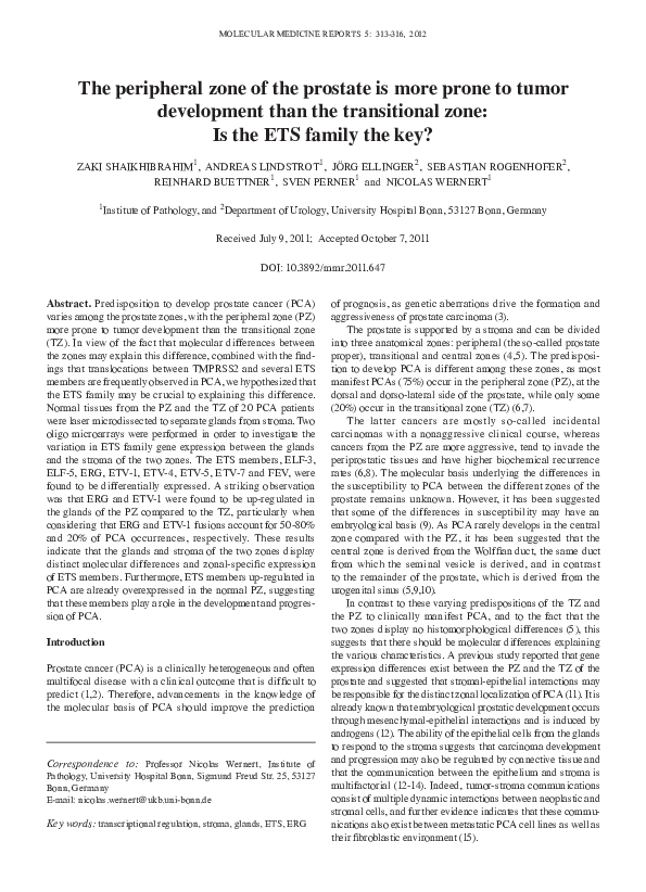 (PDF) The peripheral zone of the prostate is more prone to tumor ...