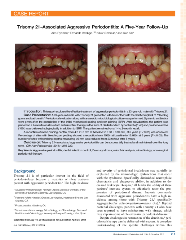 (PDF) Trisomy 21Associated Aggressive Periodontitis A FiveYear