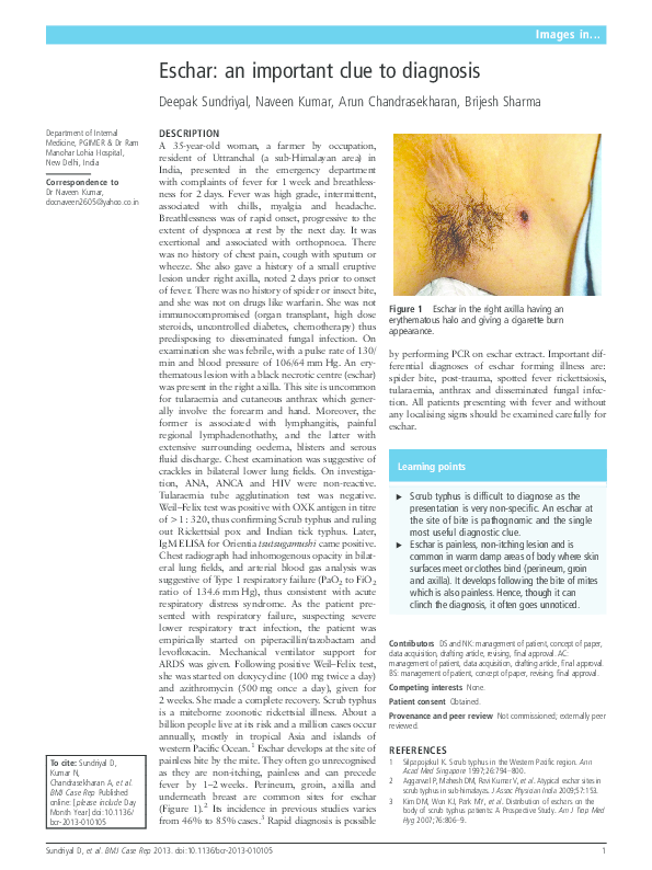 (PDF) Eschar: an important clue to diagnosis