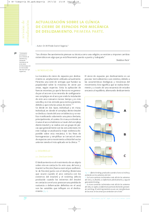 (PDF) Clinical update on the space closure with sliding mechanics