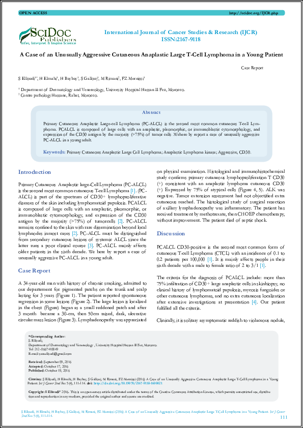 (PDF) A Case of an Unusually Aggressive Cutaneous Anaplastic Large T ...