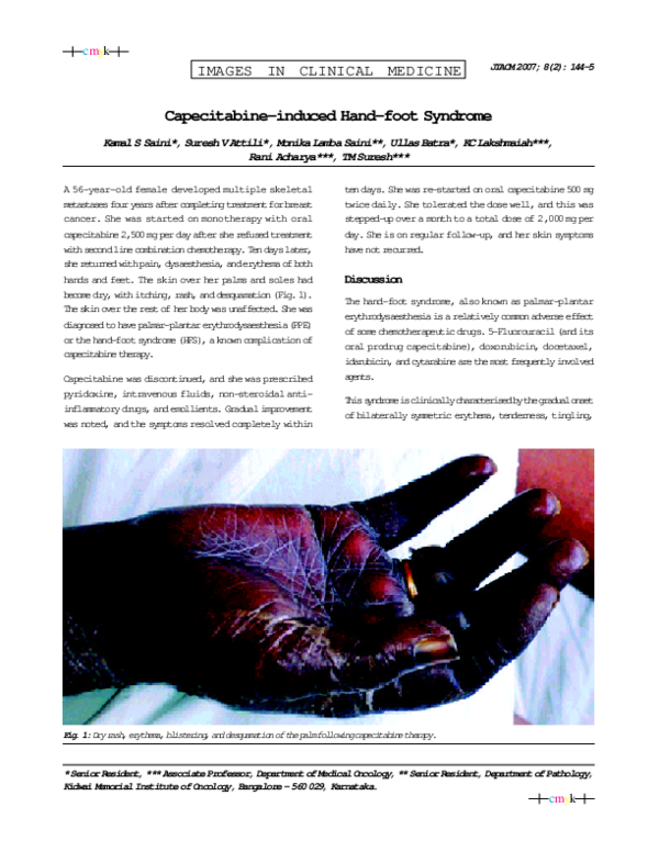 (PDF) Capecitabineinduced Handfoot Syndrome Monika Saini Academia.edu
