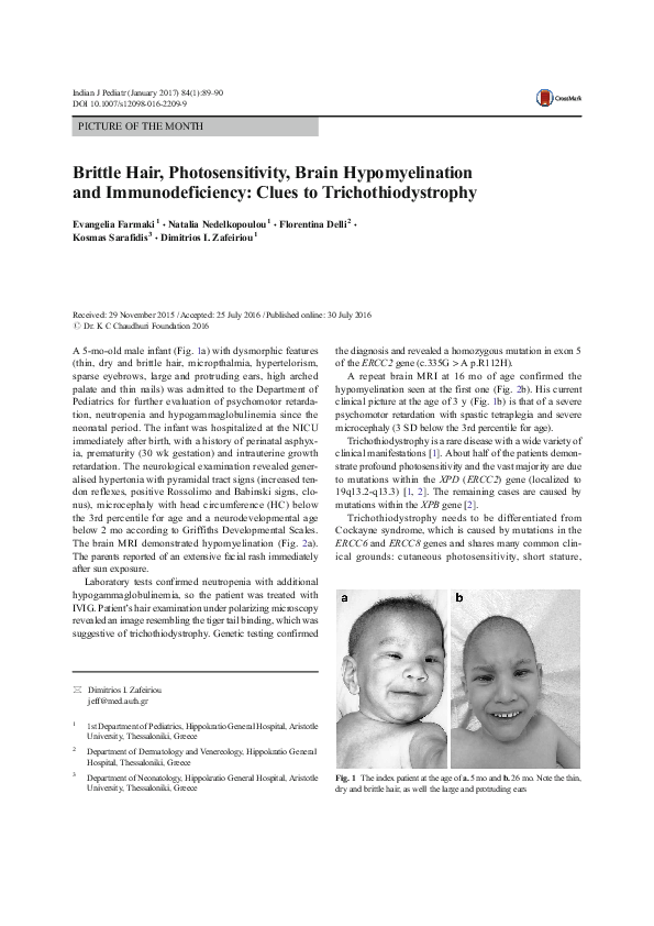 (PDF) PICTURE OF THE MONTH Brittle Hair, Photosensitivity, Brain