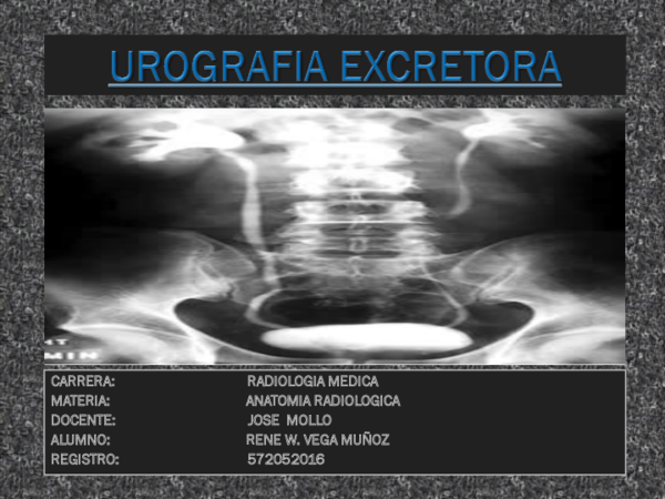 (PPT) urografia excretora