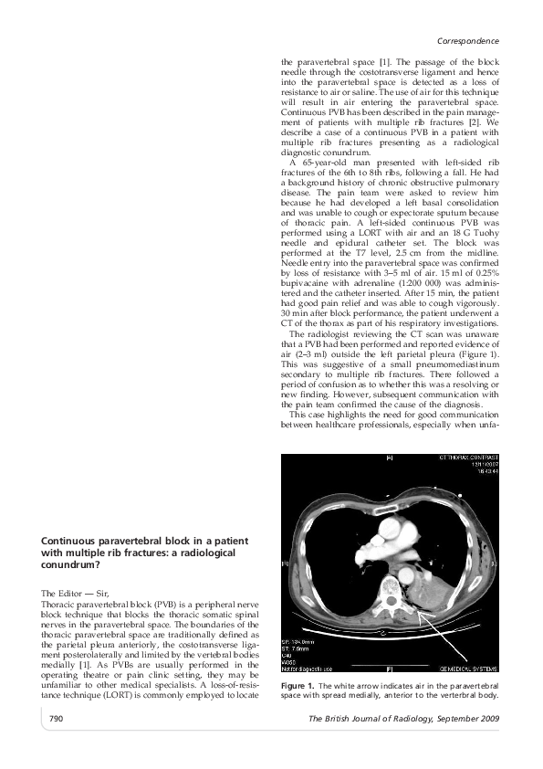(PDF) Continuous paravertebral block in a patient with multiple rib ...