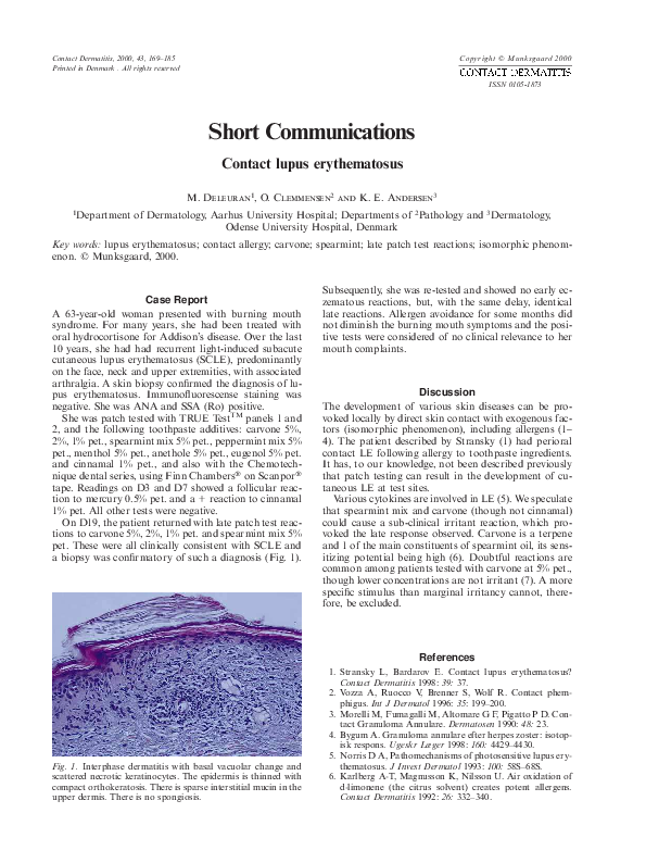 Systematic lupus ethreymosis image