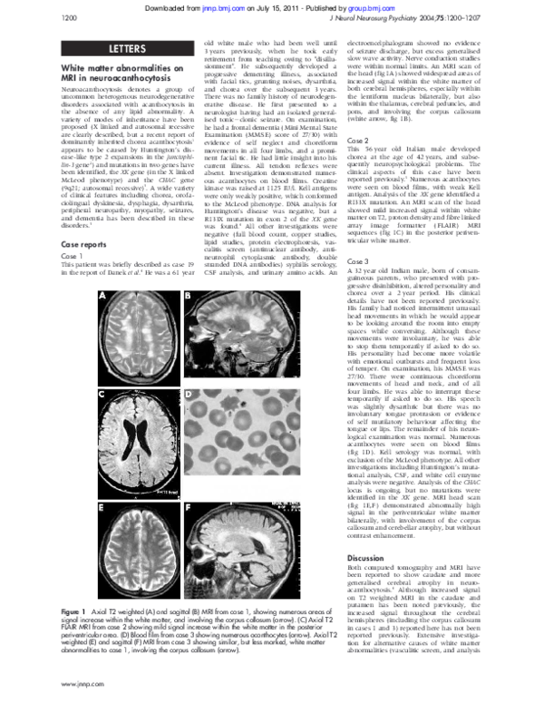 (PDF) White matter abnormalities on MRI in neuroacanthocytosis