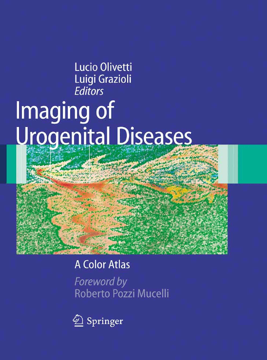 cos è un adenocarcinoma prostatico pt3 pno pm g2 vision cos è un adenocarcinoma prostatico pt3 pno pm g2 vision