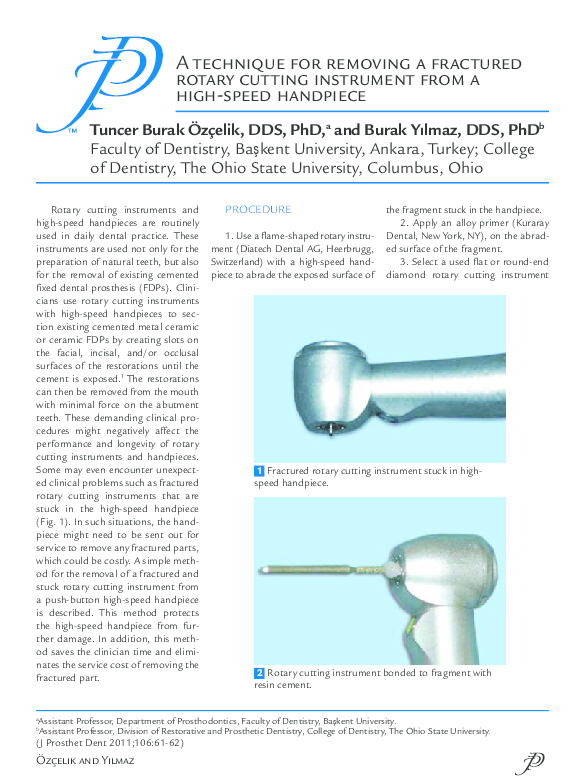 (PDF) A technique for removing a fractured rotary cutting instrument from a highspeed handpiece
