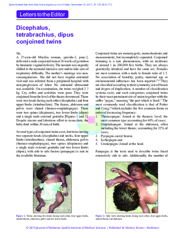 Conjoined Twins: Unicephalus Non-Janiceps Tetrapus Tetrabrachius – EBRX
