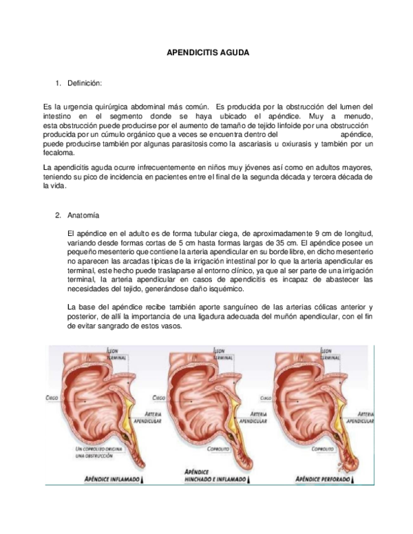 (DOC) APENDICITIS AGUDA Paola Chaupe Academia.edu