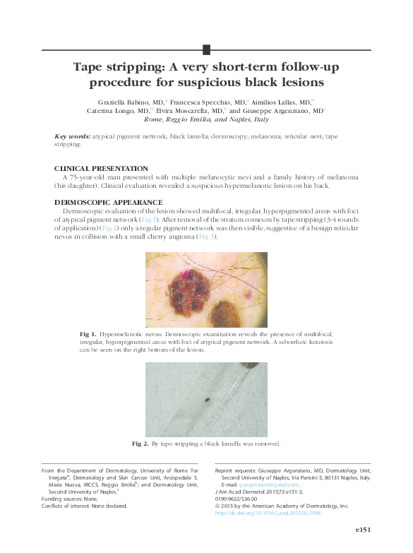 (PDF) Tape stripping A very shortterm followup procedure for