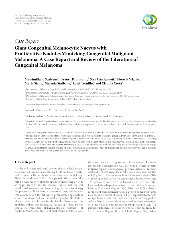 (PDF) Giant congenital melanocytic naevus with proliferative nodules ...