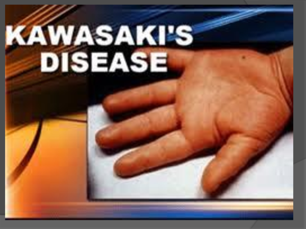 Kawasaki disease essay 06 image