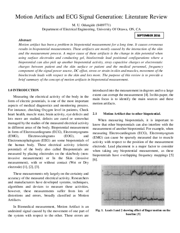 literature review on signal processing