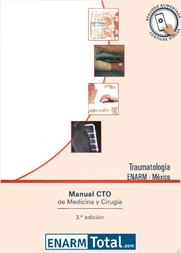 síntomas de condrólisis glenohumeral de diabetes