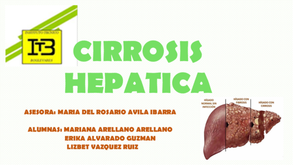 Cirrosis náuseas y vómitos