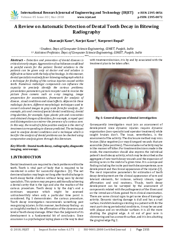 Tooth decay statistics picture