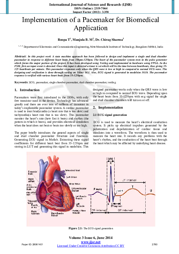 (PDF) Implementation of a Pacemaker for Biomedical Application
