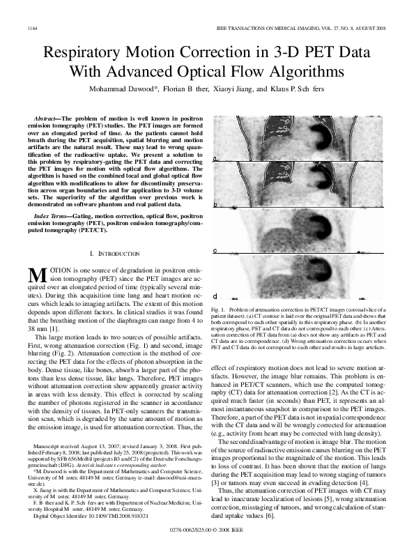 (PDF) Respiratory Motion Correction in 3-D PET Data With Advanced ...