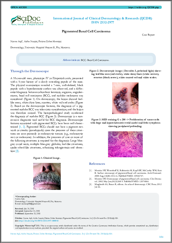 (PDF) Pigmented Basal Cell Carcinoma International Journal of