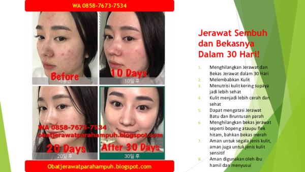 Obat Penghilang Bekas Jerawat Research Papers Academia Edu