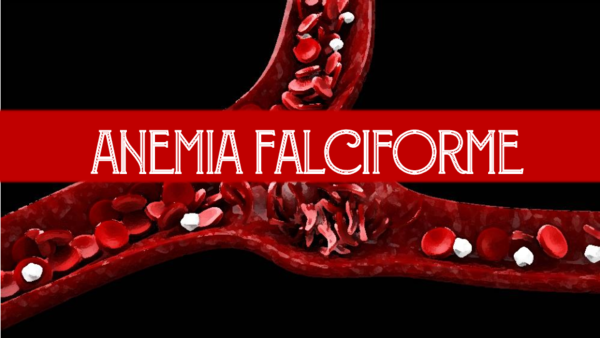 Anémie Falciforme Pdf _ La drépanocytose – YKPHK