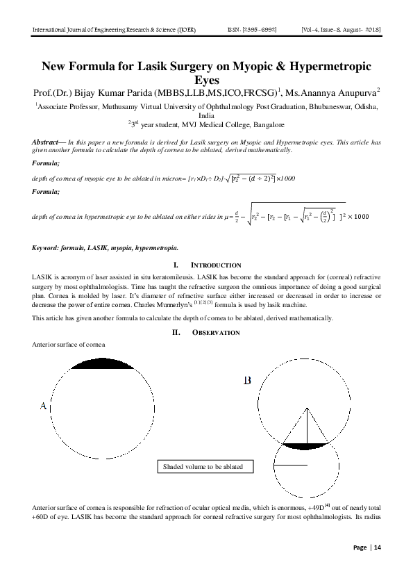 Lasik article picture