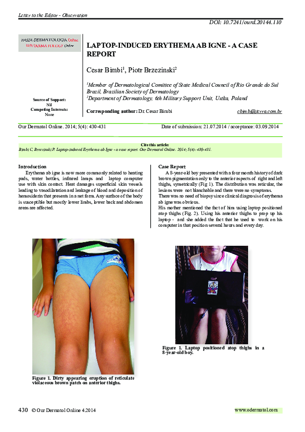 (PDF) Laptop-induced Erythema ab Igne – a case report