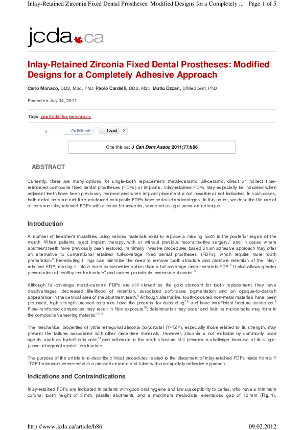 (PDF) Inlay-retained zirconia fixed dental prostheses: modified designs ...