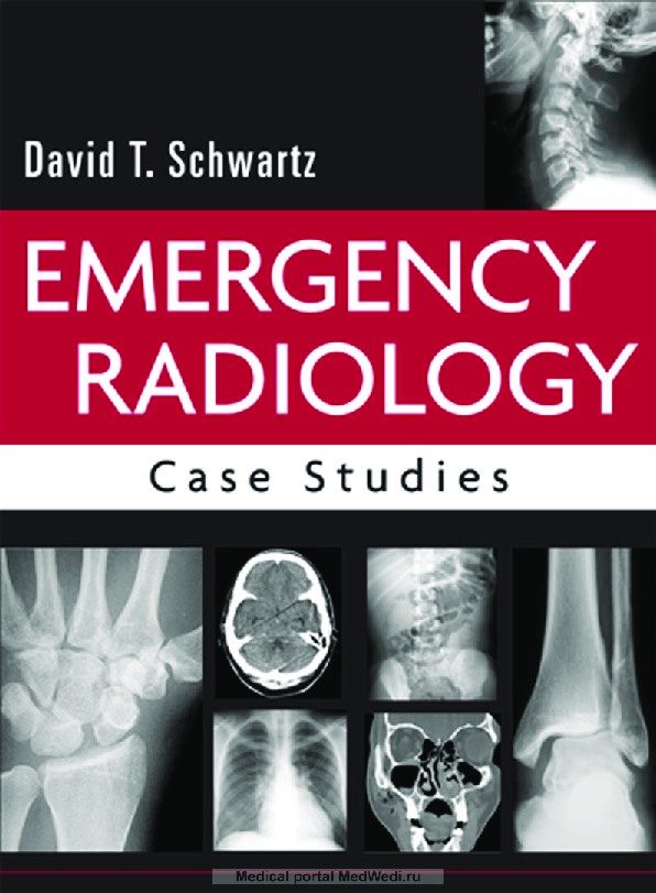 PDF) Emergency Radiology Case Studies.pdf copy