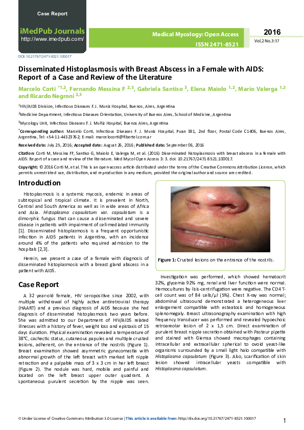 (PDF) Disseminated Histoplasmosis with Breast Abscess in a Female with ...
