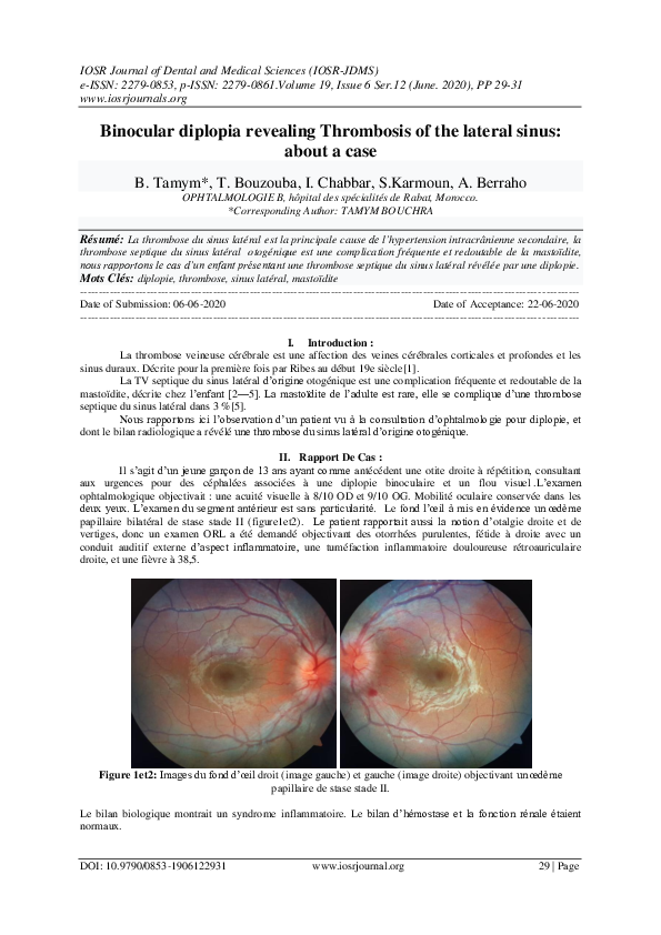 (PDF) Binocular diplopia revealing Thrombosis of the lateral sinus about a case IOSR Journals