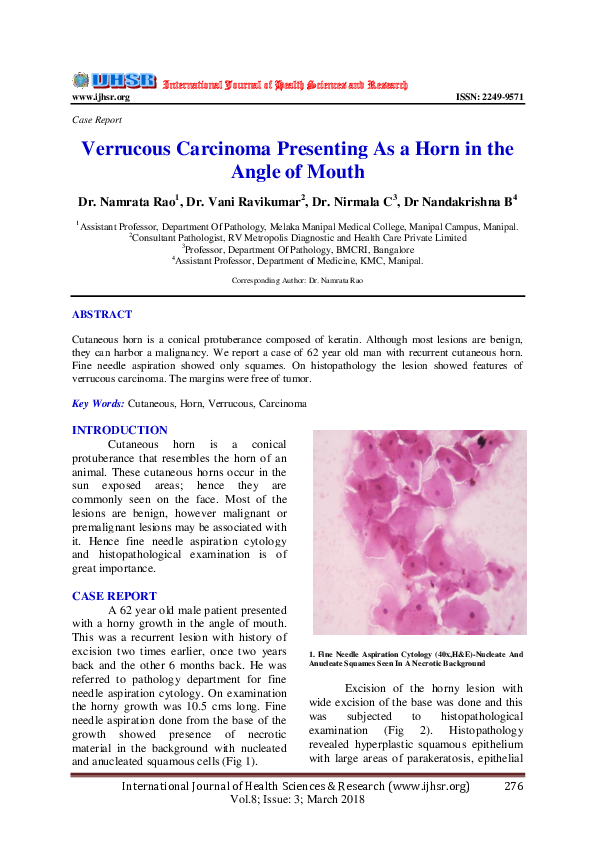 (PDF) Verrucous Carcinoma Presenting As a Horn in the Angle of Mouth