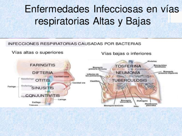 (PDF) Enfermedades Infecciosas en vías respiratorias Altas y Bajas