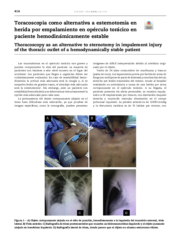 (PDF) Artículo toracoscopia.